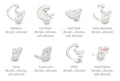 Ear Molds